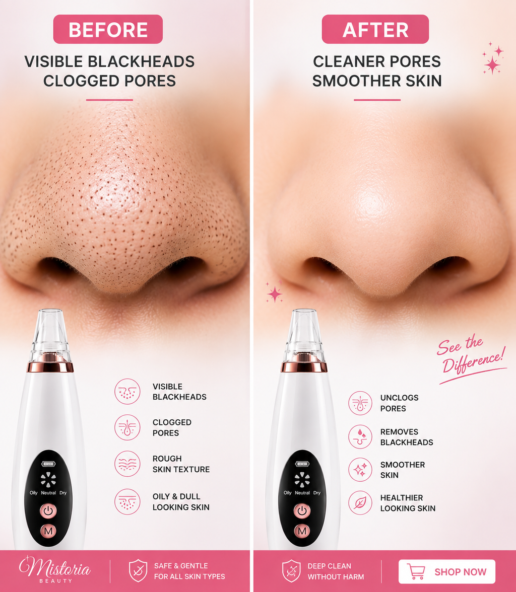 Facial Pore Vacuum Cleaner& Blackhead Removal