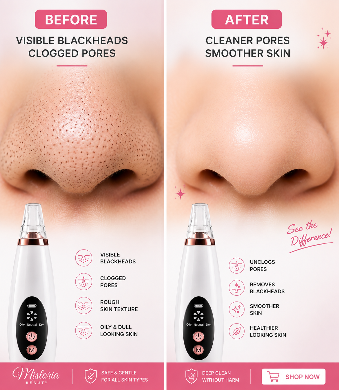 Facial Pore Vacuum Cleaner& Blackhead Removal